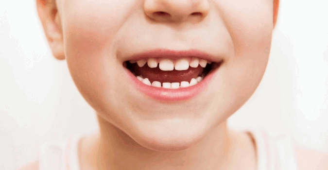 Slik hjelper du barnet ditt med tannpussen